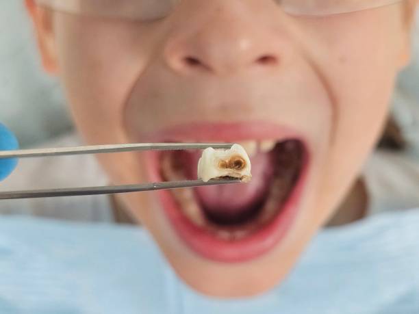 Best Tooth Infection Emergency Dentist  in Indialantic, FL